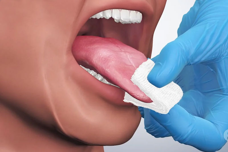Oral Cancer Screening